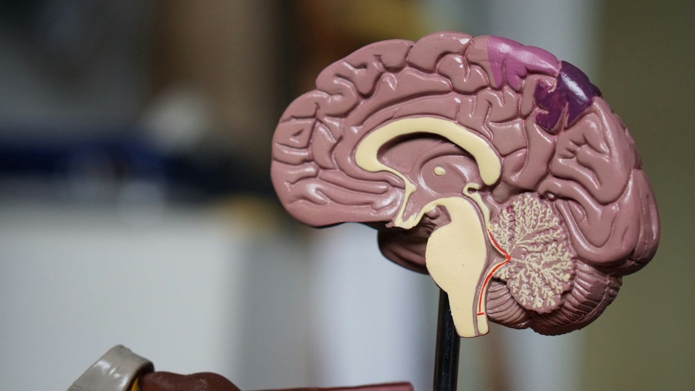 Words Used to Talk About Neurodivergence